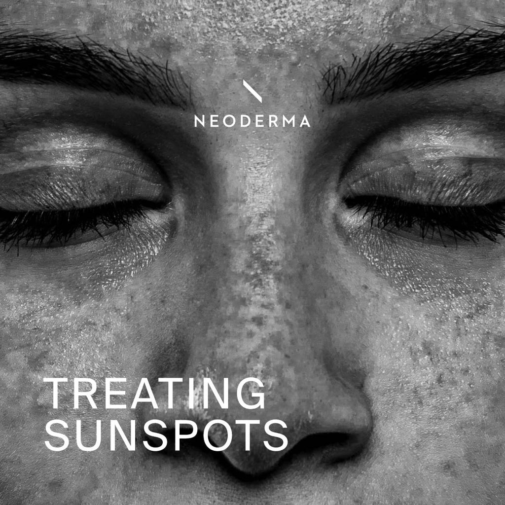 Treating Sunspots