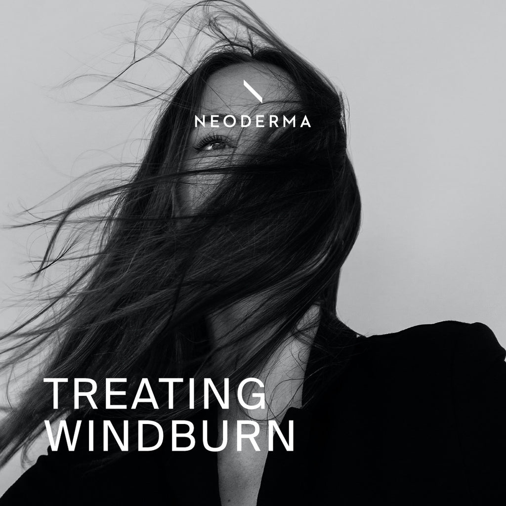 Treating Windburn