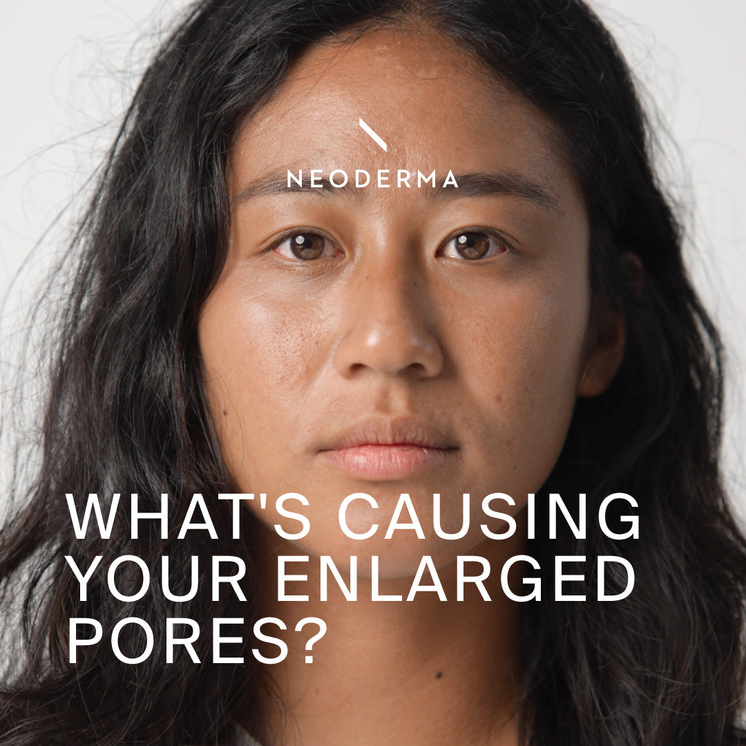 What's Causing Your Enlarged Pores?