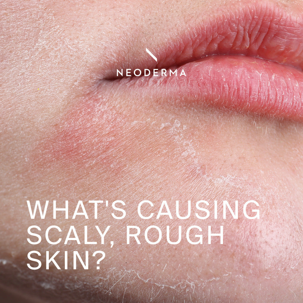 What's Causing Scaly, Rough Skin?