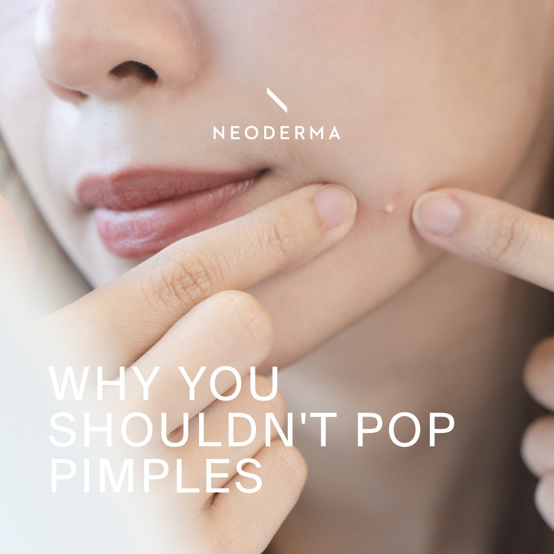 Why You Shouldn't Pop Pimples