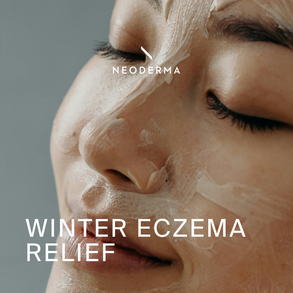 Winter Eczema Relief