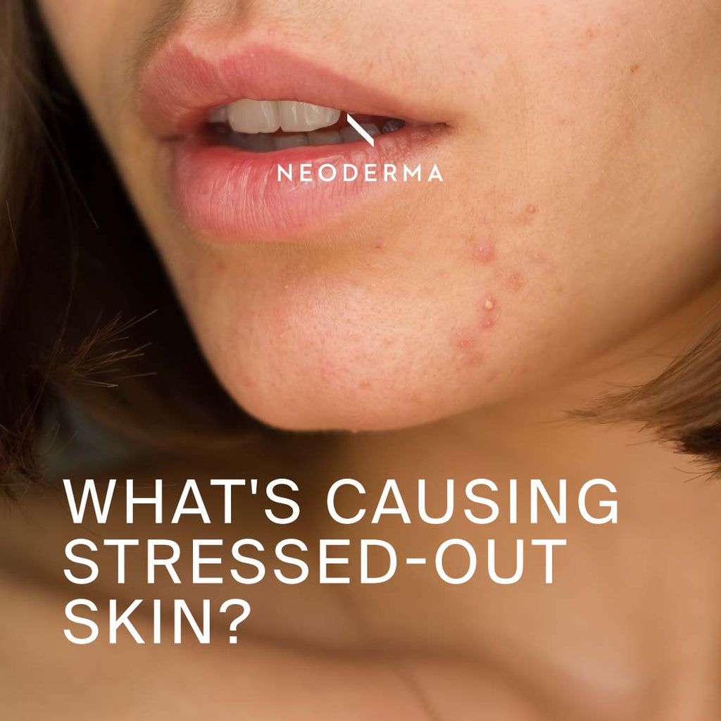 What's Causing Stressed-Out Skin?